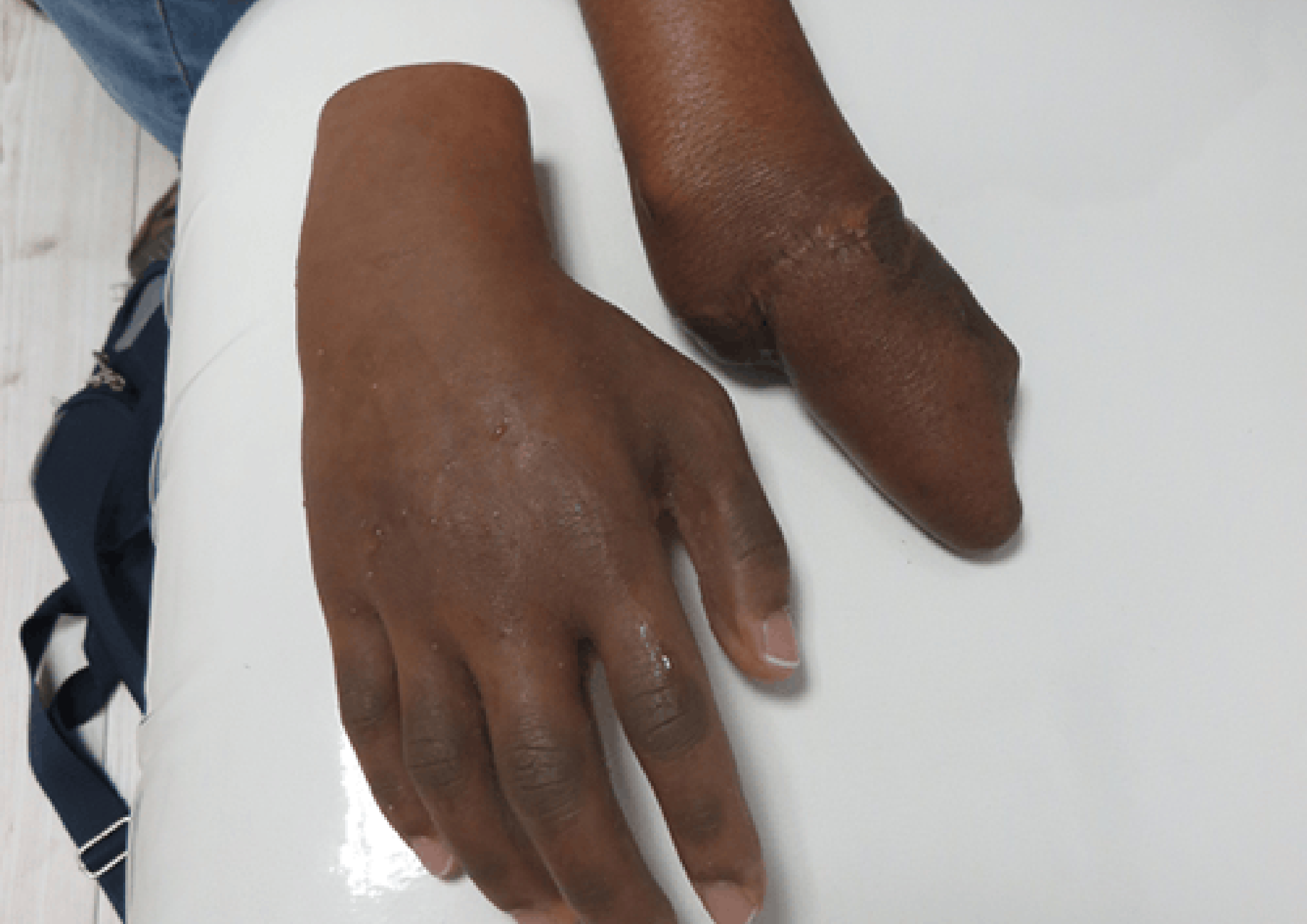 High Definition Medical Grade Silicone Skin Tone Blending